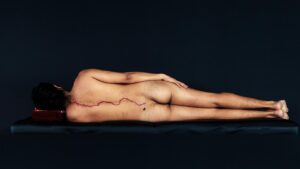 A naked person lies on side, back shows a blood line of the US-Mexico border